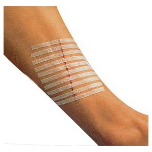 Αυτοκόλλητα Ράμματα 38 x 6 mm - Σε 12 άτοκες δόσεις