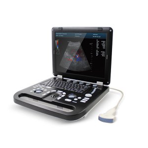 Έγχρωμος Φορητός Υπέρηχος Doppler CONTEC CMS1700C | Convex Array Probe 3.5MHz - Σε 12 άτοκες δόσεις